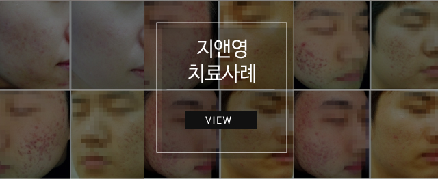 지앤영 치료사례