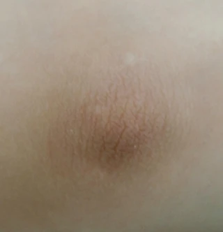 AFTER 이미지