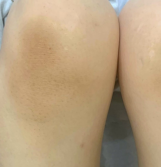 AFTER 이미지