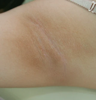 BEFORE 이미지